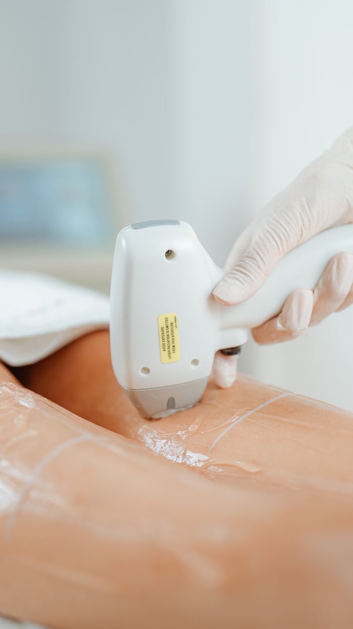 Mastering the First Impression: Your intriguing post title goes here Close-up of laser hair removal procedure in beauty clinic, showcasing diode laser technology on a client's leg.